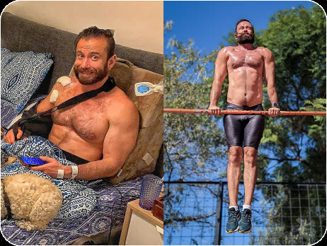 Member after shoulder surgery wearing a sling, and the same member later performing bar muscle-ups outdoors
